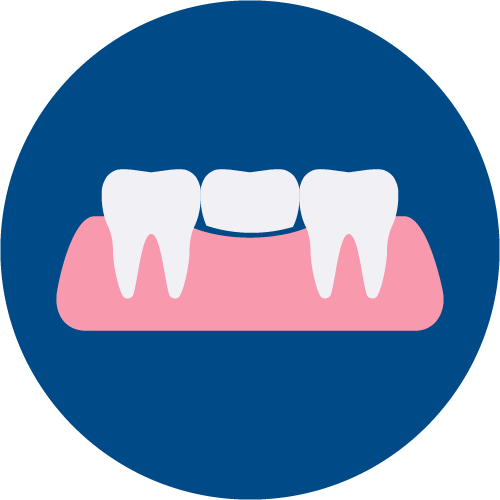 PrÃ³tesis dental