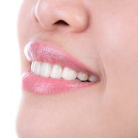 Blanqueamiento Dental en Valencia