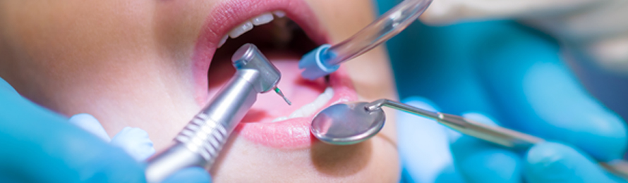 Endodoncia en Valencia