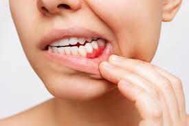 Periodoncia en Ruzafa