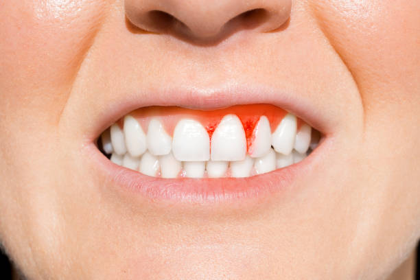 periodoncista en el centro de valencia